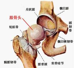 股骨头坏死