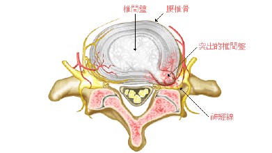 腰背痛