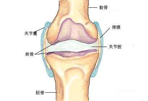 膝关节滑膜炎