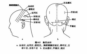 脑瘫/截瘫